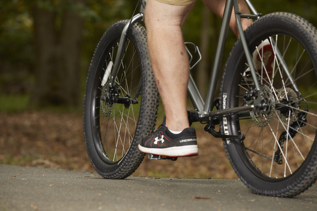 E-Bike Pedal Maintenance: Tips for Keeping Your Pedals Smooth